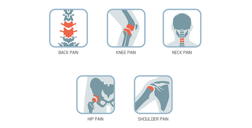 RFA treatment areas