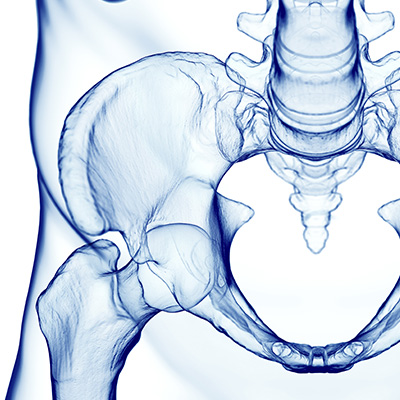 Hip surgery xray